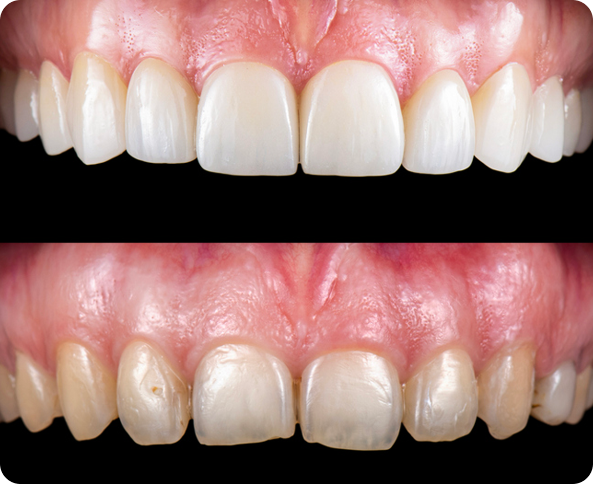 Before and after dental treatment
