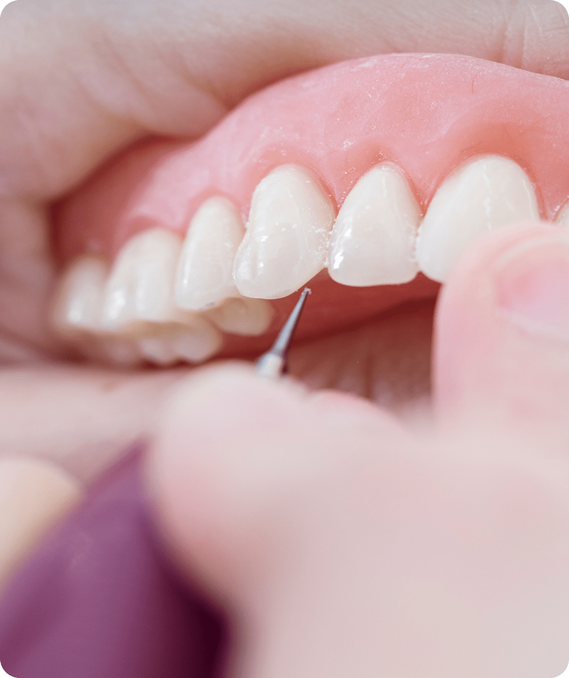 benefit-5-v2_feature_image (11)