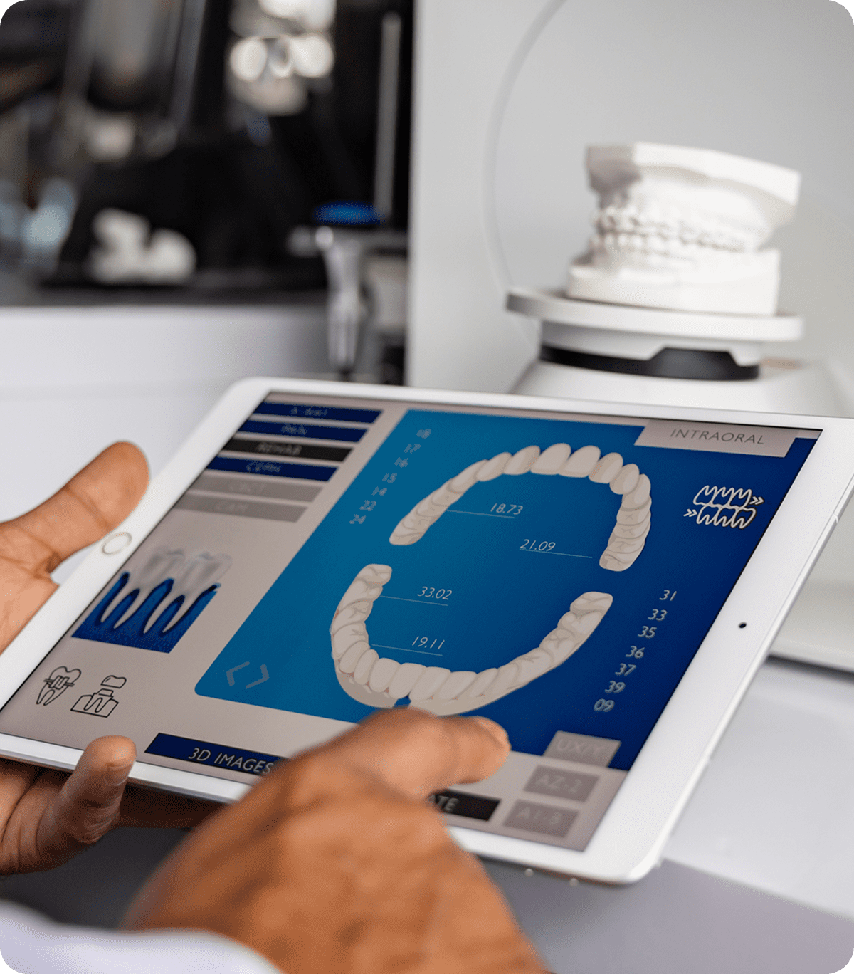 Digital dental impression on screen