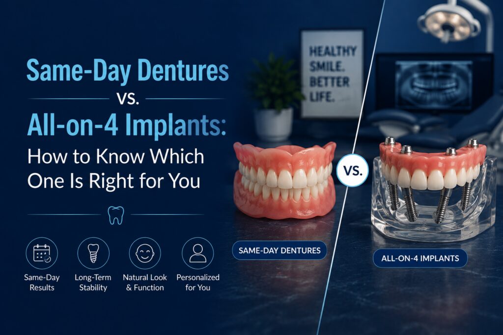 Same-Day Dentures vs. All-on-4 Implants: How to Know Which One Is Right for You